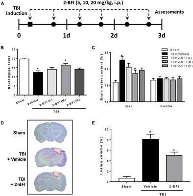 2-BFI Provides Neuroprotection Against Inflammation and Necroptosis in a Rat Model of Traumatic Brain Injury